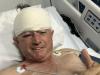Ex-Zimbabwe cricketer Guy Whittall survives ‘deadly’ leopard attack