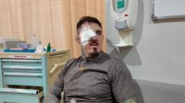 Usman and Cejudo show support for Aspinall after UFC 321 eye injury